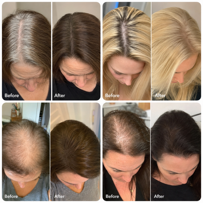Hair Density Filler For Her